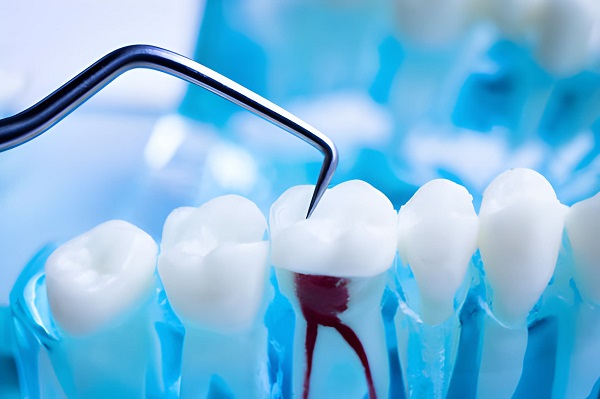 Best Root canal Dentist in kharghar